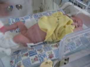 Nagyér transzpozíció: ha időben műtik, nincs agykárosodás