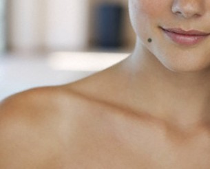 Őszi anyajegy-hullás